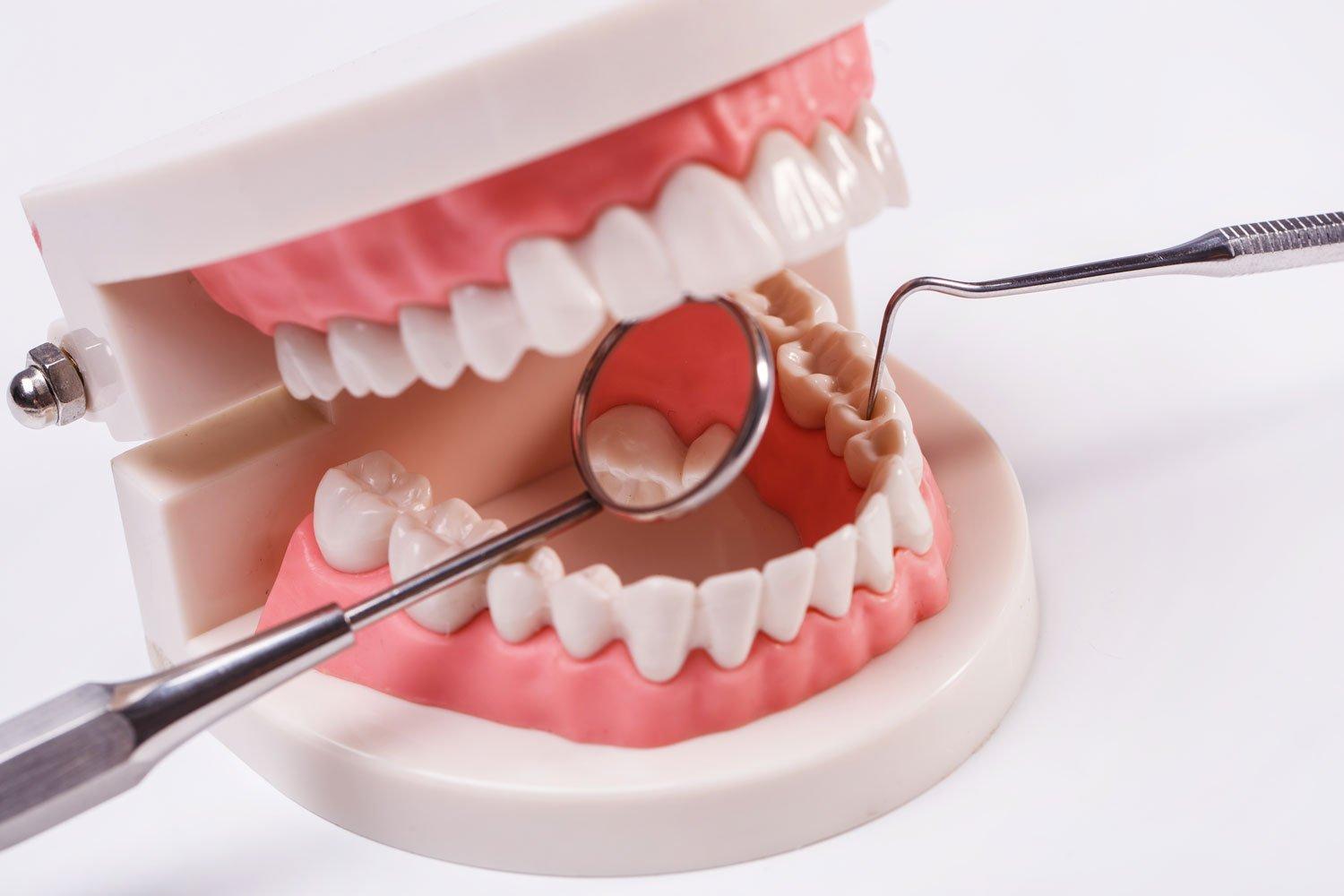 Dentures