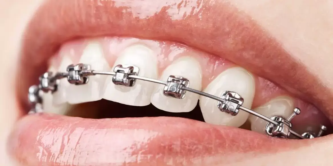 Orthodontics