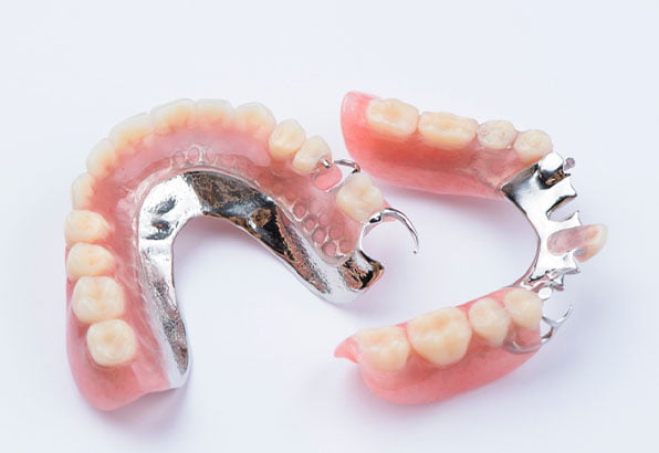 Partial Denture