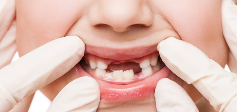 Pediatric Dentistry