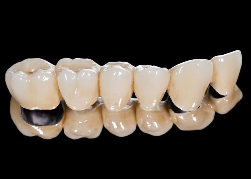 Smile Design